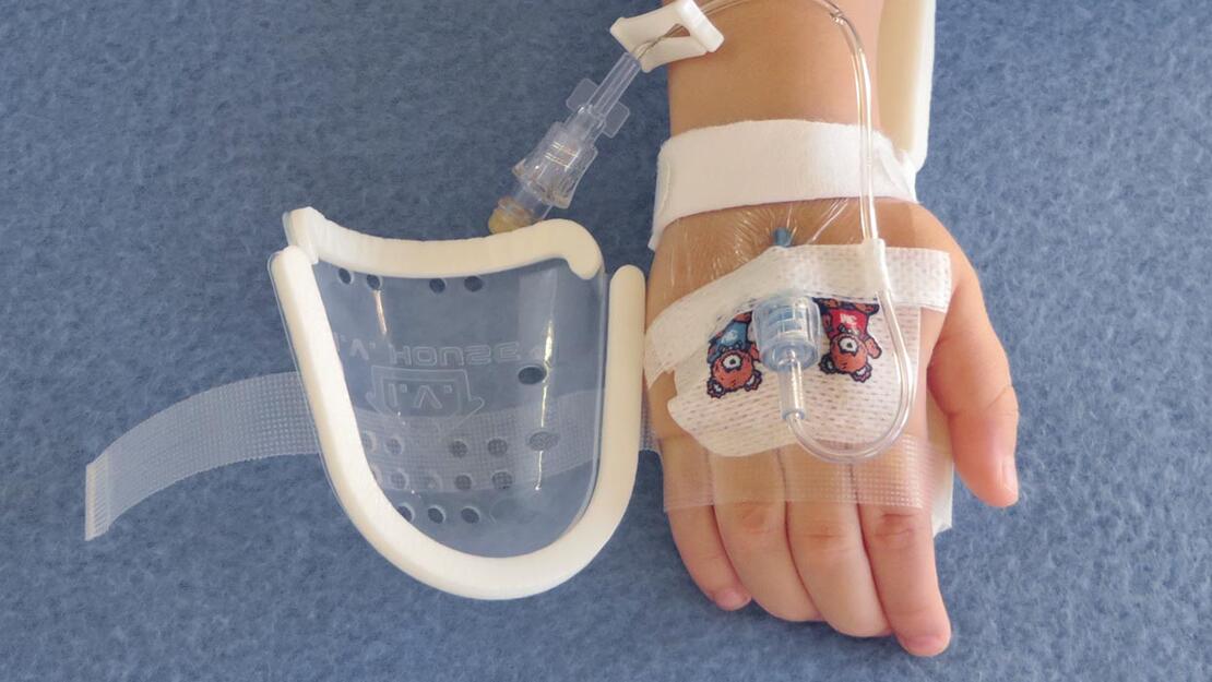 UltraDome and TLC Splint on child's hand