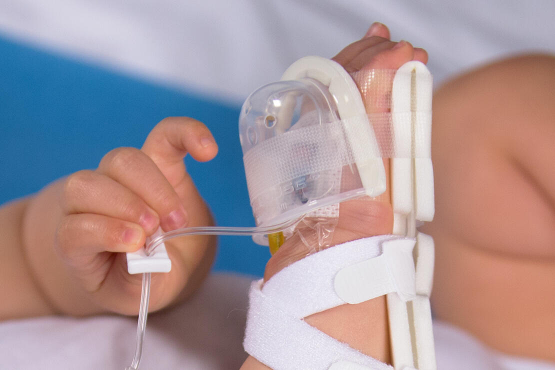 727SFP I.V. House UltraDome on infant's hand