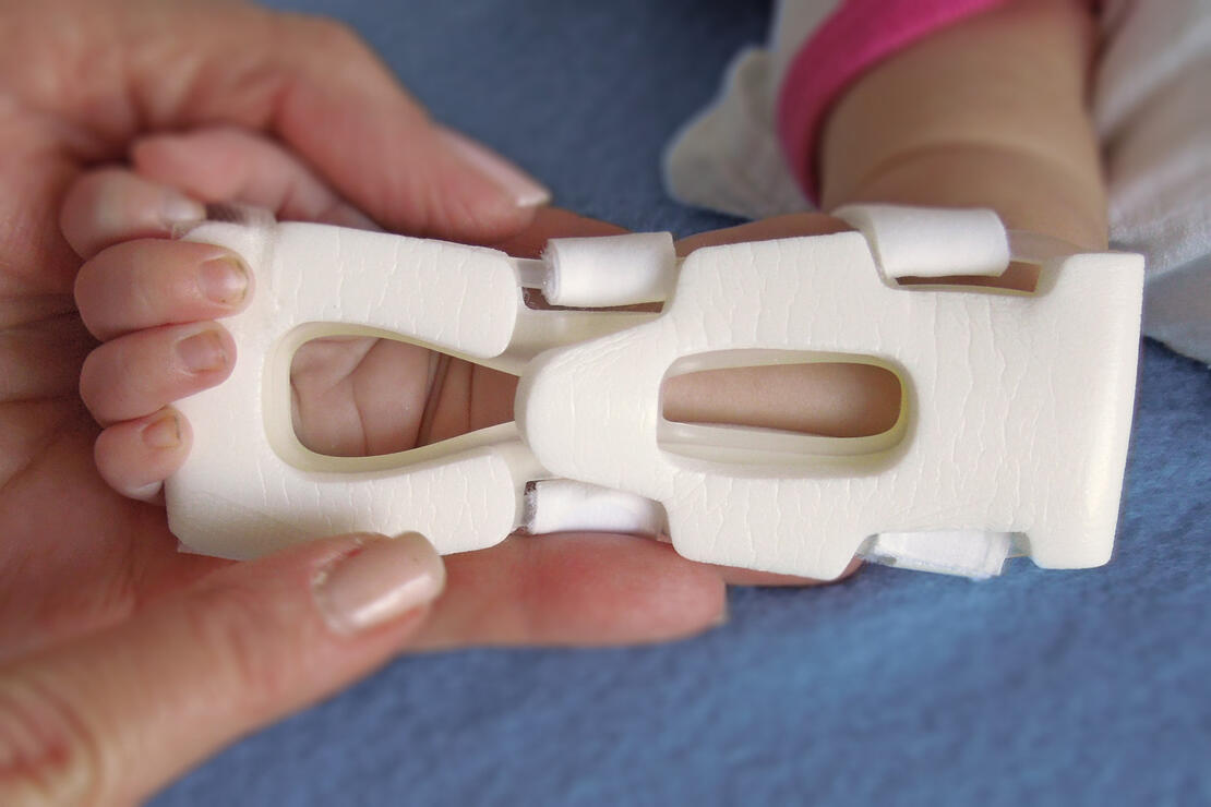 939S-Ultra TLC Wrist Splint, assessing underside of infant's wrist