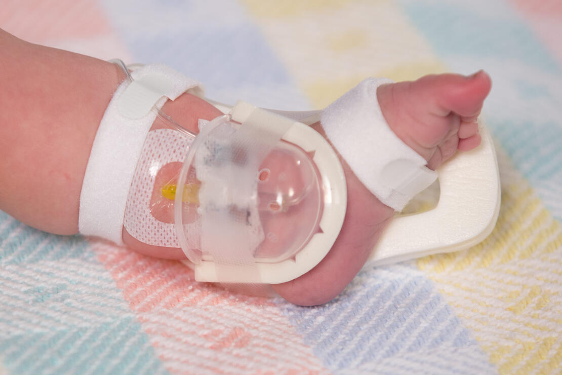 949XS TLC Foot Splint and 727SFP I.V. House UltraDressing on infant
