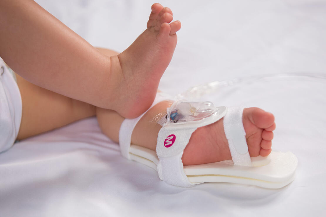 330M I.V. House UltraDressing on infant's ankle