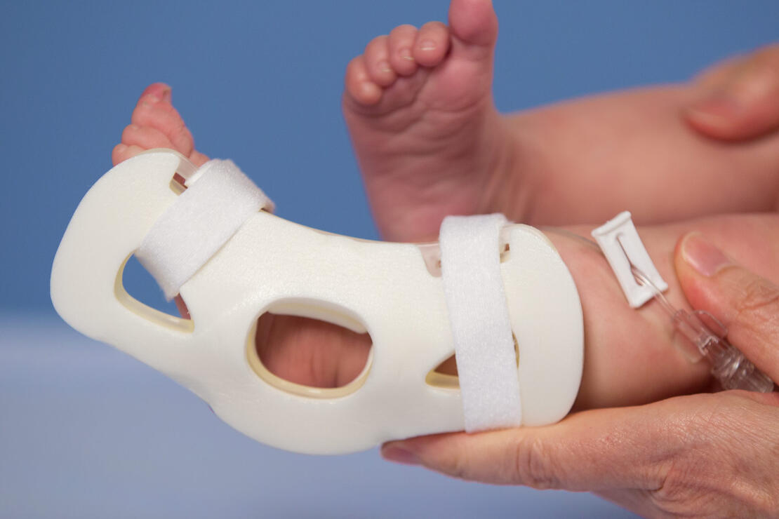 949XS TLC Foot Splint on infant