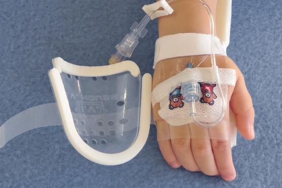 UltraDome and TLC Splint on child's hand